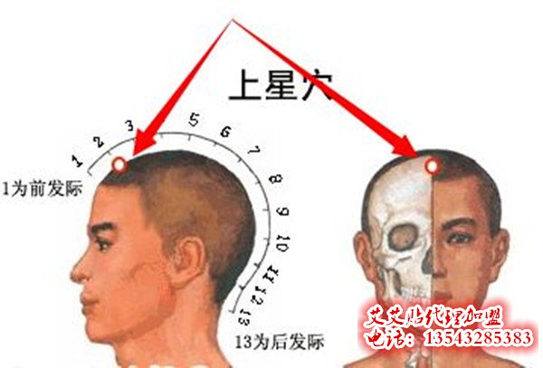 艾艾贴调理上星穴位指示图