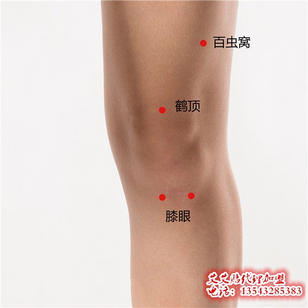 艾艾贴调理膝眼穴位指示图