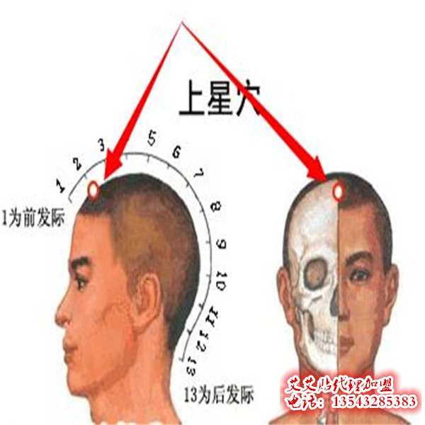 艾艾贴调理上星穴位指示图