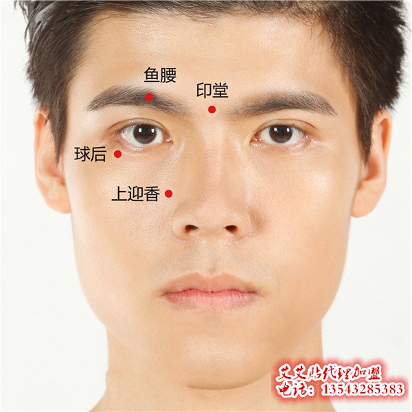 艾艾贴调理印堂穴位指示图