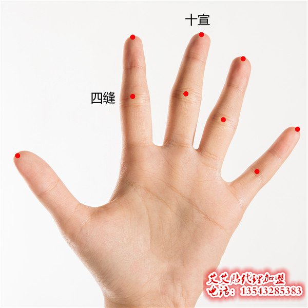 艾艾贴调理四缝穴位指示图