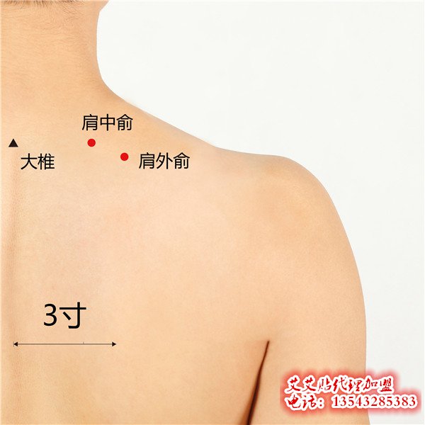 艾艾贴调理肩外俞穴位指示图