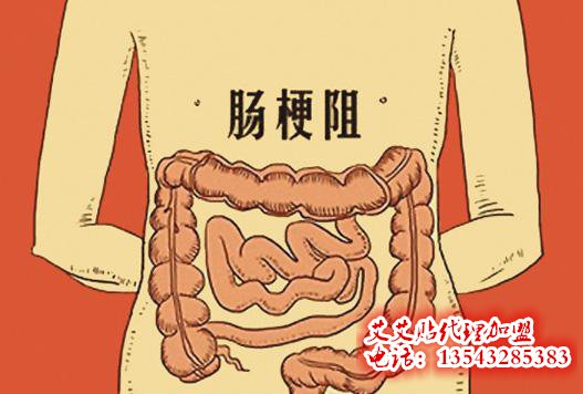 用艾艾贴如何调理肠梗阻?