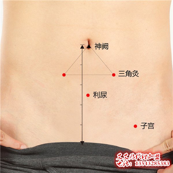 艾艾贴