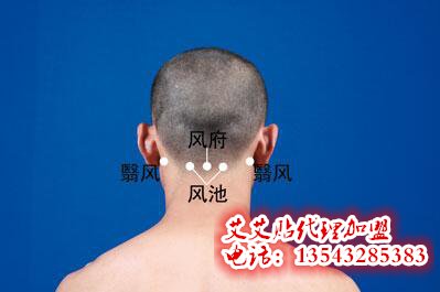 艾艾贴风府穴位置图片 艾艾贴风府穴位置图片