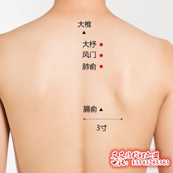 风门穴如何使用艾艾贴艾灸呢? 风门穴如何使用艾艾贴艾灸呢?