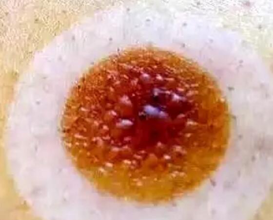 艾艾贴排病反应 艾艾贴排病反应