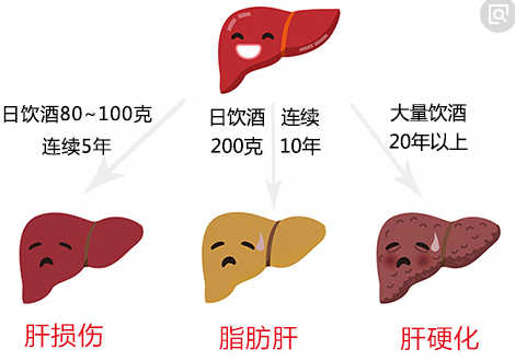 艾艾贴艾灸调理脂肪肝案例 艾艾贴艾灸调理脂肪肝案例