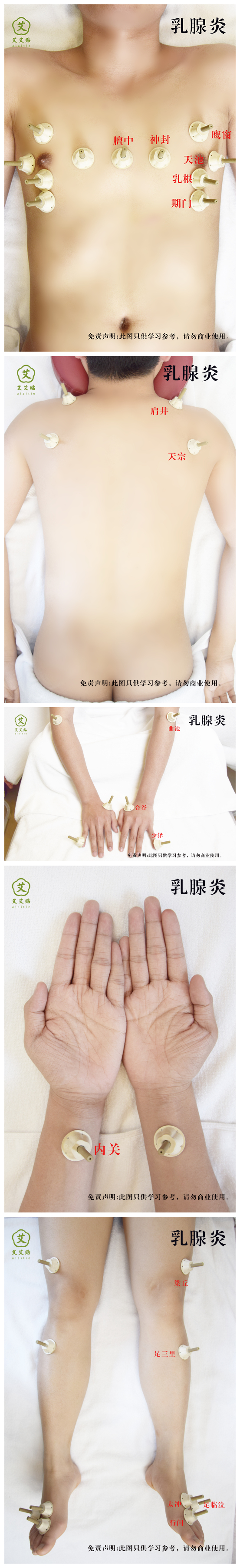 艾艾贴调理乳腺炎的方法 艾艾贴调理乳腺炎的方法