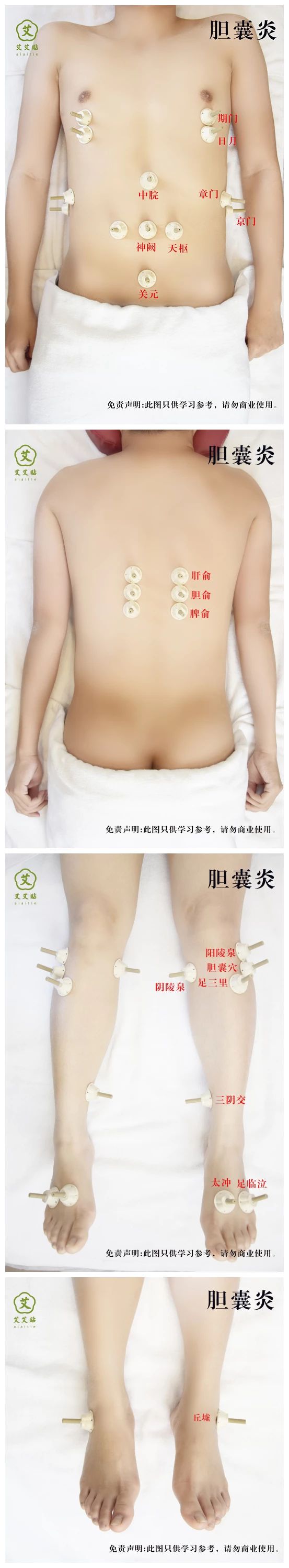 艾艾贴调理胆囊炎的方法 艾艾贴调理胆囊炎的方法