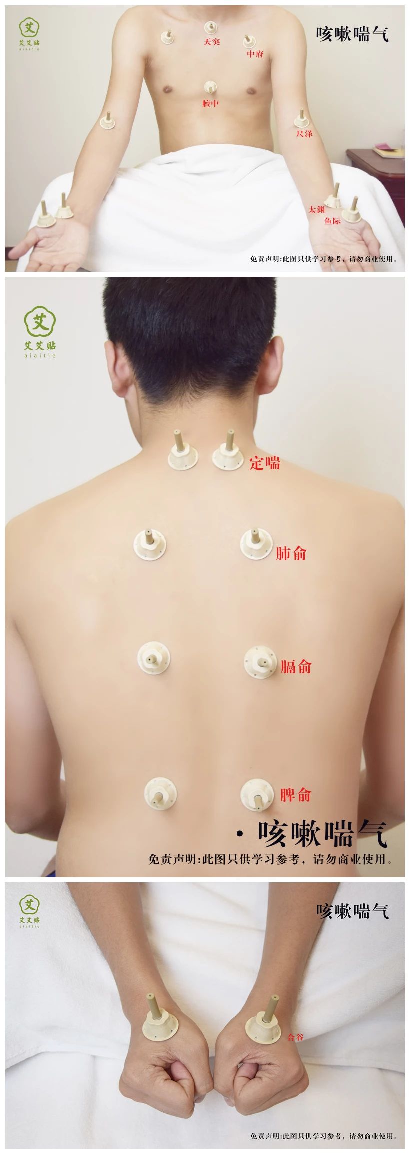 艾艾贴哮喘 艾艾贴哮喘