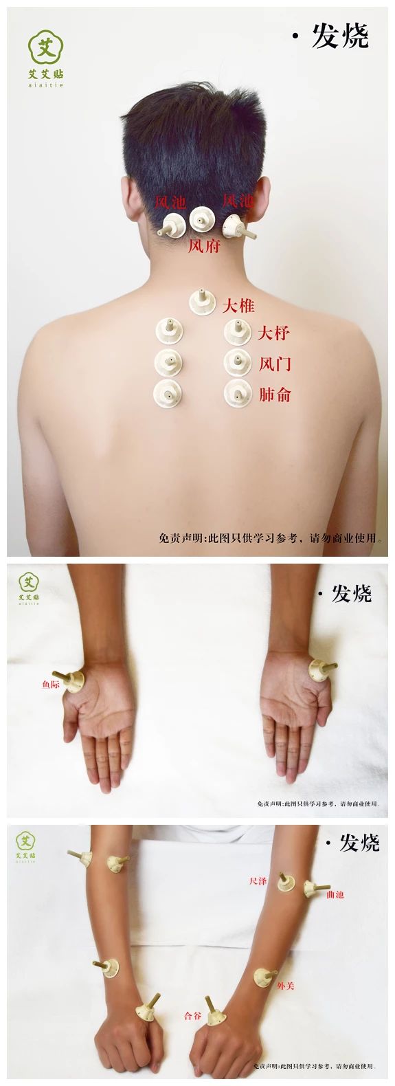 发烧的艾艾贴艾灸调理方法