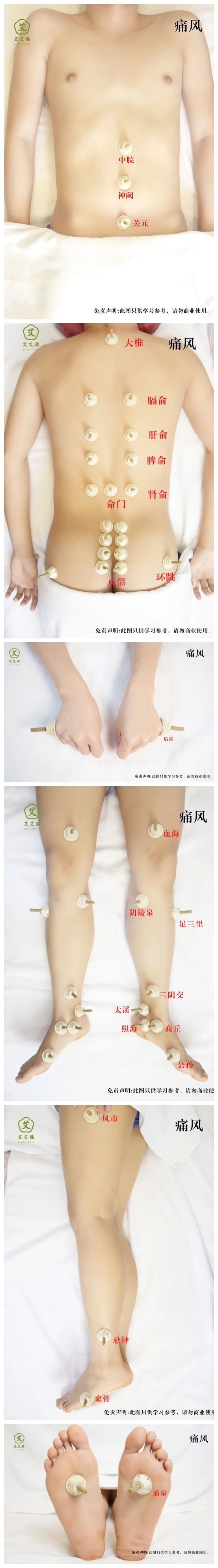 艾艾贴调理痛风 艾艾贴调理痛风