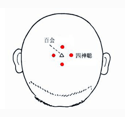 艾艾贴百会穴位图片