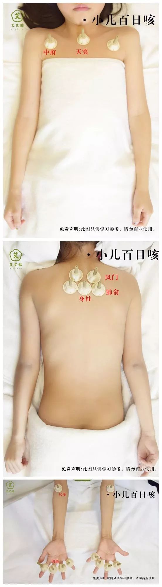 小儿百日咳的艾灸图 小儿百日咳的艾灸图