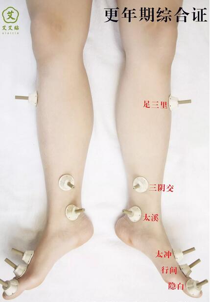 更年期综合症的艾灸图