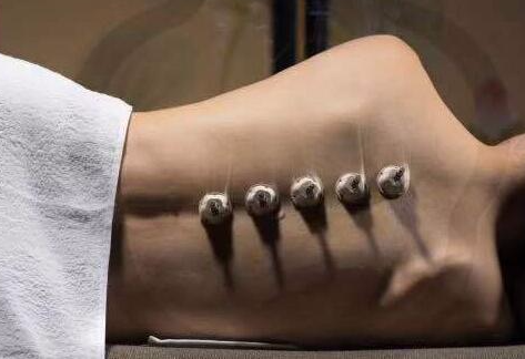 艾艾贴灸半身的图片