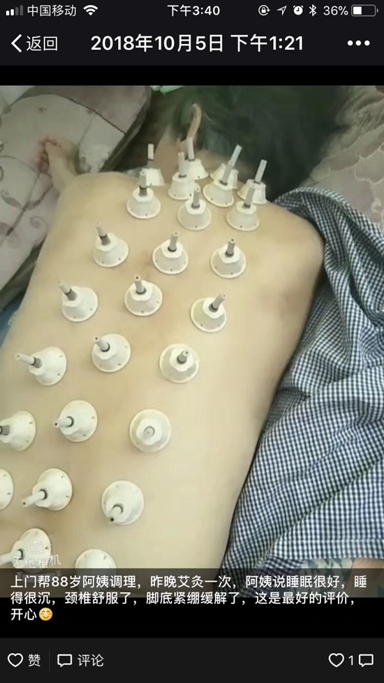 艾艾贴艾灸调理:白内障