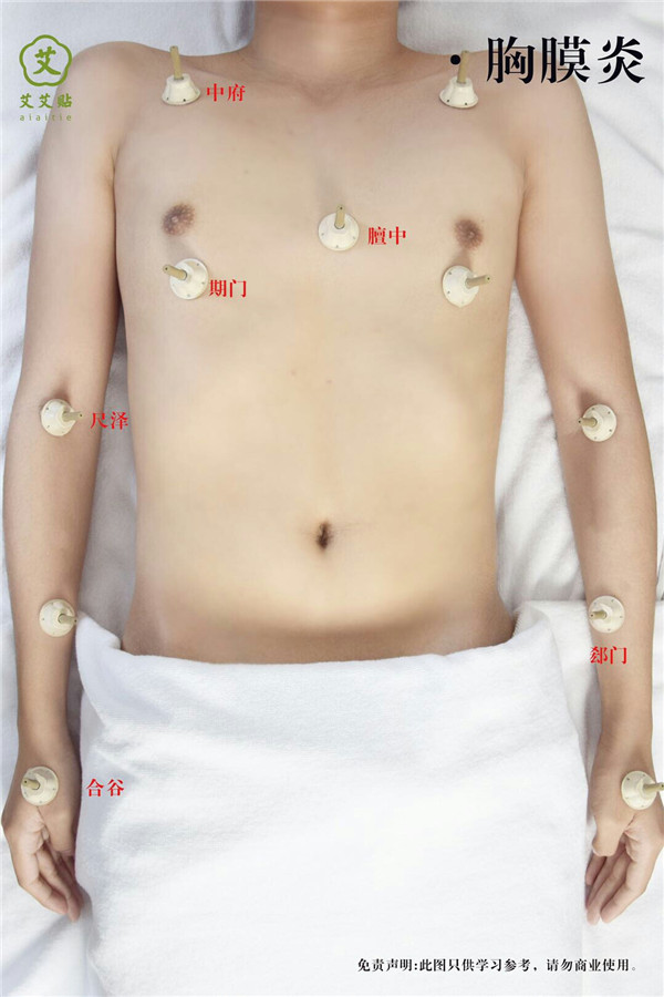 胸膜炎艾灸哪里？怎么贴？艾艾贴使用方法