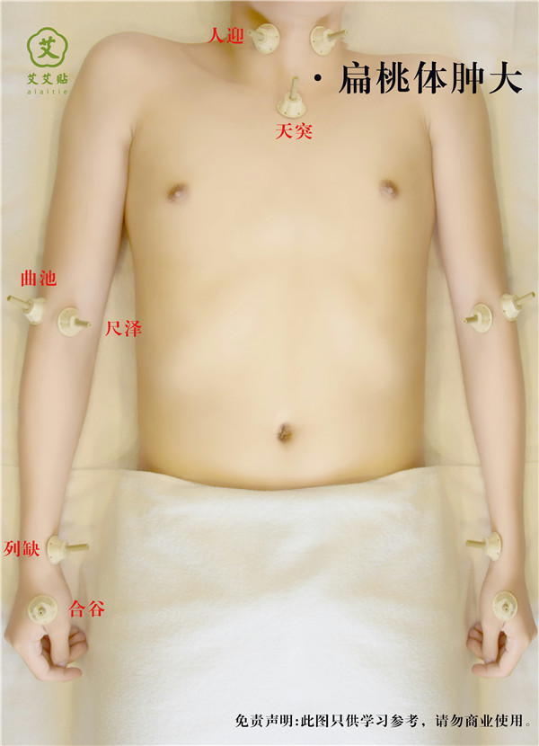 扁桃体肿大艾灸哪里？怎么贴？艾艾贴使用方法