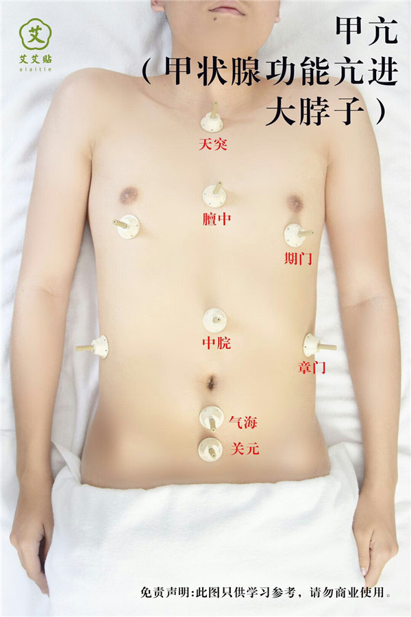 甲亢艾灸哪里？怎么贴？艾艾贴使用方法 穴位图