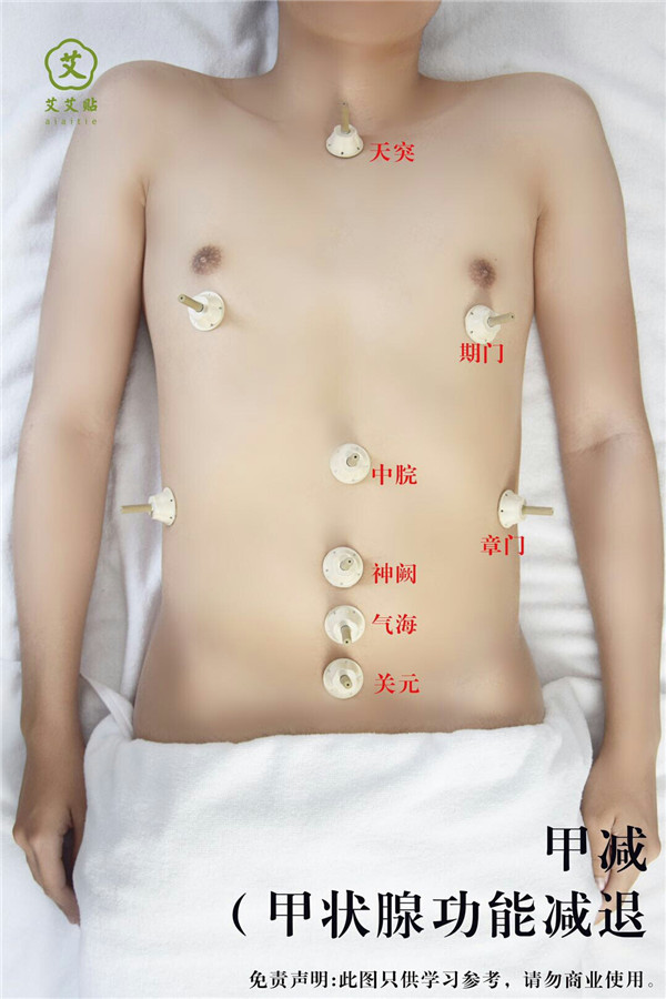 甲状腺功能减退艾灸哪里？怎么贴？艾艾贴使用