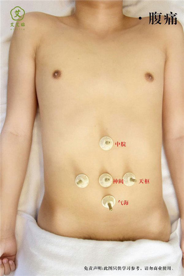 腹痛艾灸哪里？怎么贴？艾艾贴使用方法 穴位图