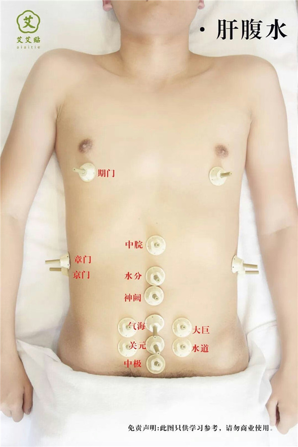 肝腹水艾灸哪里？怎么贴？艾艾贴使用方法