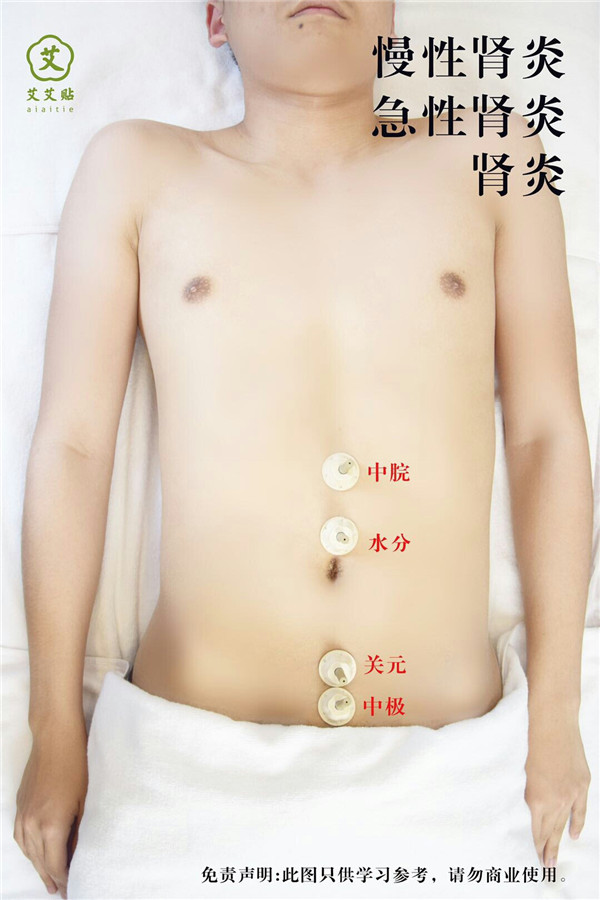 肾炎艾灸哪里？怎么贴？艾艾贴使用方法 穴位图