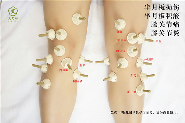 骨刺艾灸哪里？怎么贴？艾艾贴使用方法 穴位图