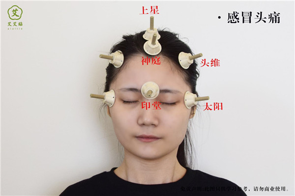 感冒头痛艾灸哪里？--艾艾贴分享