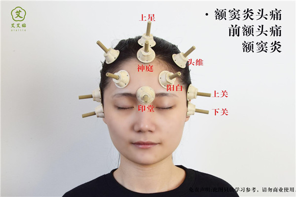 前额头痛艾灸哪里？怎么贴？艾艾贴使用方法