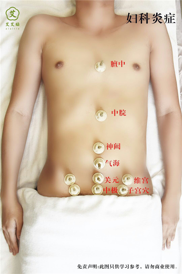 宫颈炎艾灸哪里？怎么贴？艾艾贴使用方法