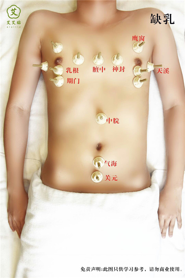 缺奶艾灸哪里？怎么贴？艾艾贴使用方法 穴位图