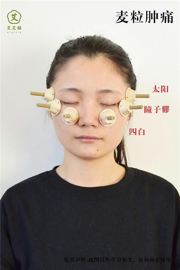 麦粒肿痛艾灸哪里？怎么贴？艾艾贴使用方法