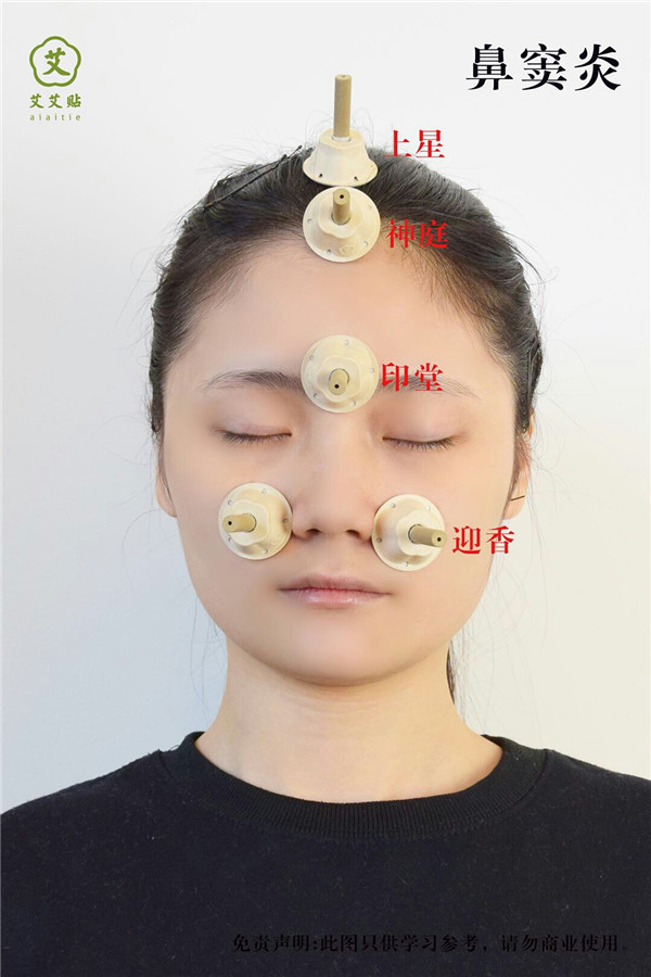 鼻窦炎艾灸哪里？怎么贴？艾艾贴使用方法