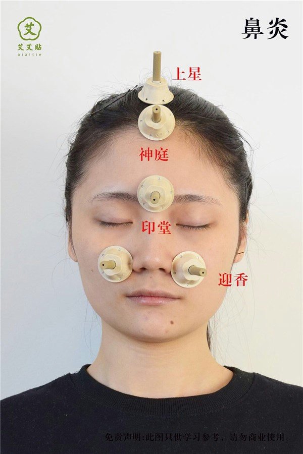 鼻炎艾灸哪里？怎么贴？艾艾贴使用方法 穴位图